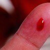 Какие это могут быть последствия приворота на крови?